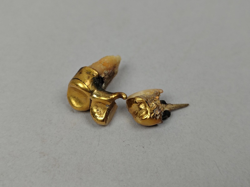 Tandguld, orensat